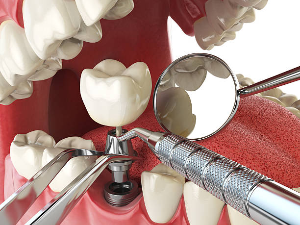 Best Emergency Dental Services for Seniors in Port Chester, NY